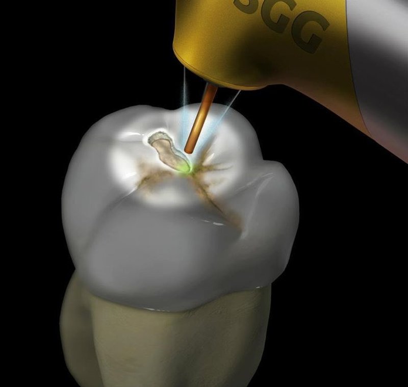 Advanced Gentle Dentist - Clinica stomatologica, Bucuresti