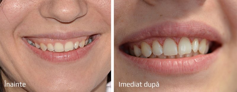 Advanced Gentle Dentist - Clinica stomatologica, Bucuresti