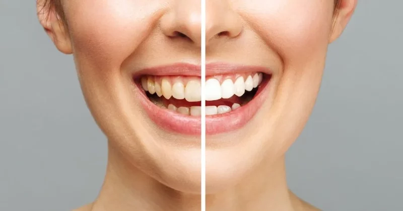 Advanced Gentle Dentist - Clinica stomatologica, Bucuresti