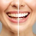 Advanced Gentle Dentist - Clinica stomatologica, Bucuresti